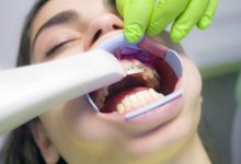 Photo of 4 Essential Facts of Emergency Dentistry