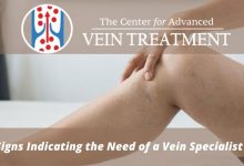 Photo of Signs Indicating the Need of a Vein Specialist