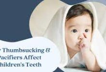 Photo of Thumb Sucking and Pacifiers: Influence of these activities on a Child’s teeth