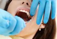 Photo of Wisdom Tooth Removal: A Brief Guide to the Procedure