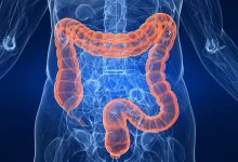 Photo of Colon cleansing benefits